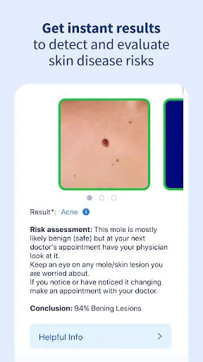 AI Dermatologist