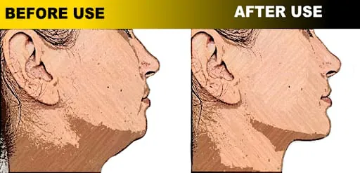 Jaw Muscles Exercises