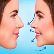 Rhinoplasty App