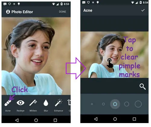 Face Acne Remover Photo Editor