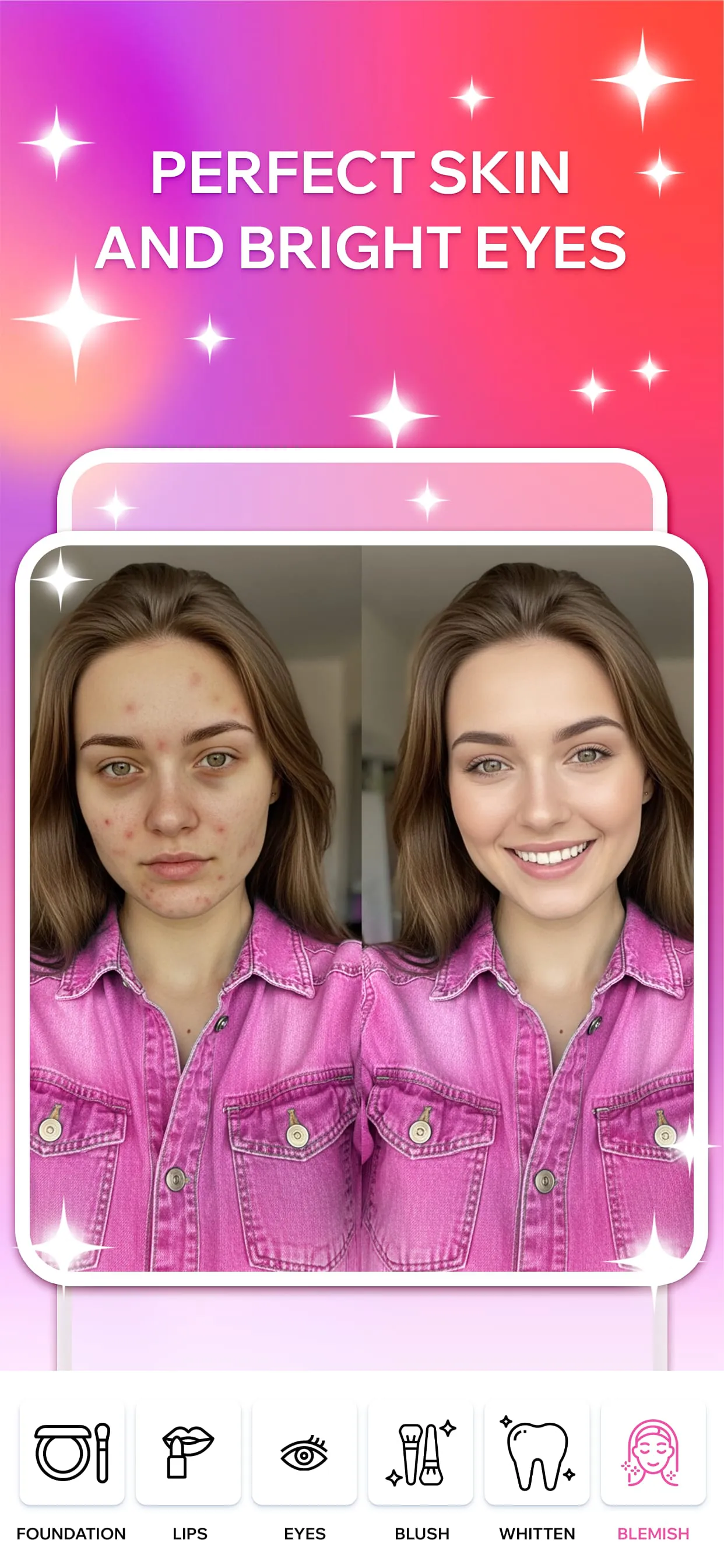 Pimple Remover & Makeup Cam