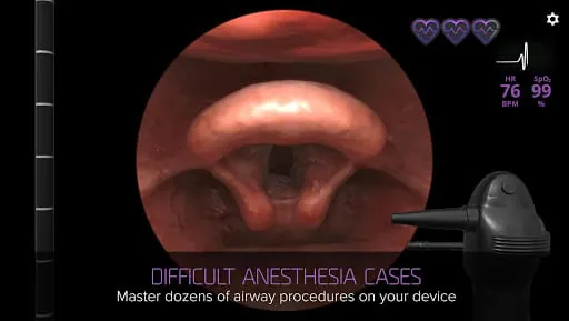 Airway Ex