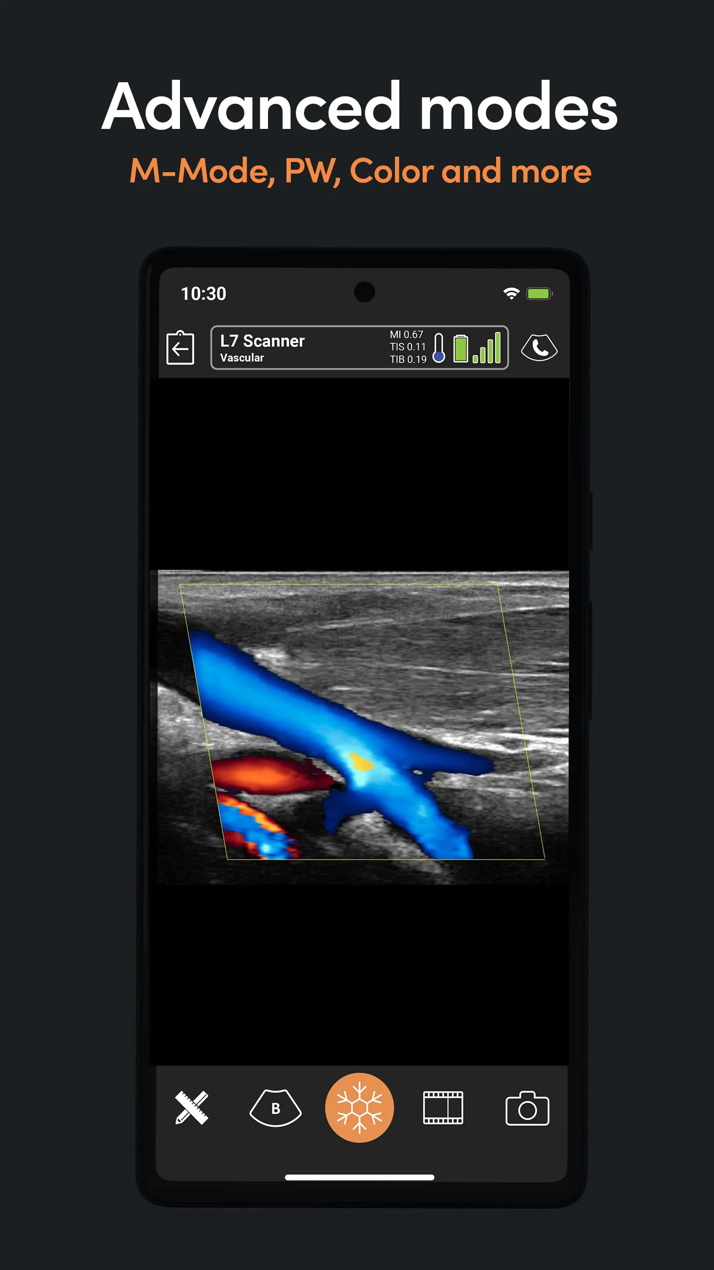 Clarius Ultrasound