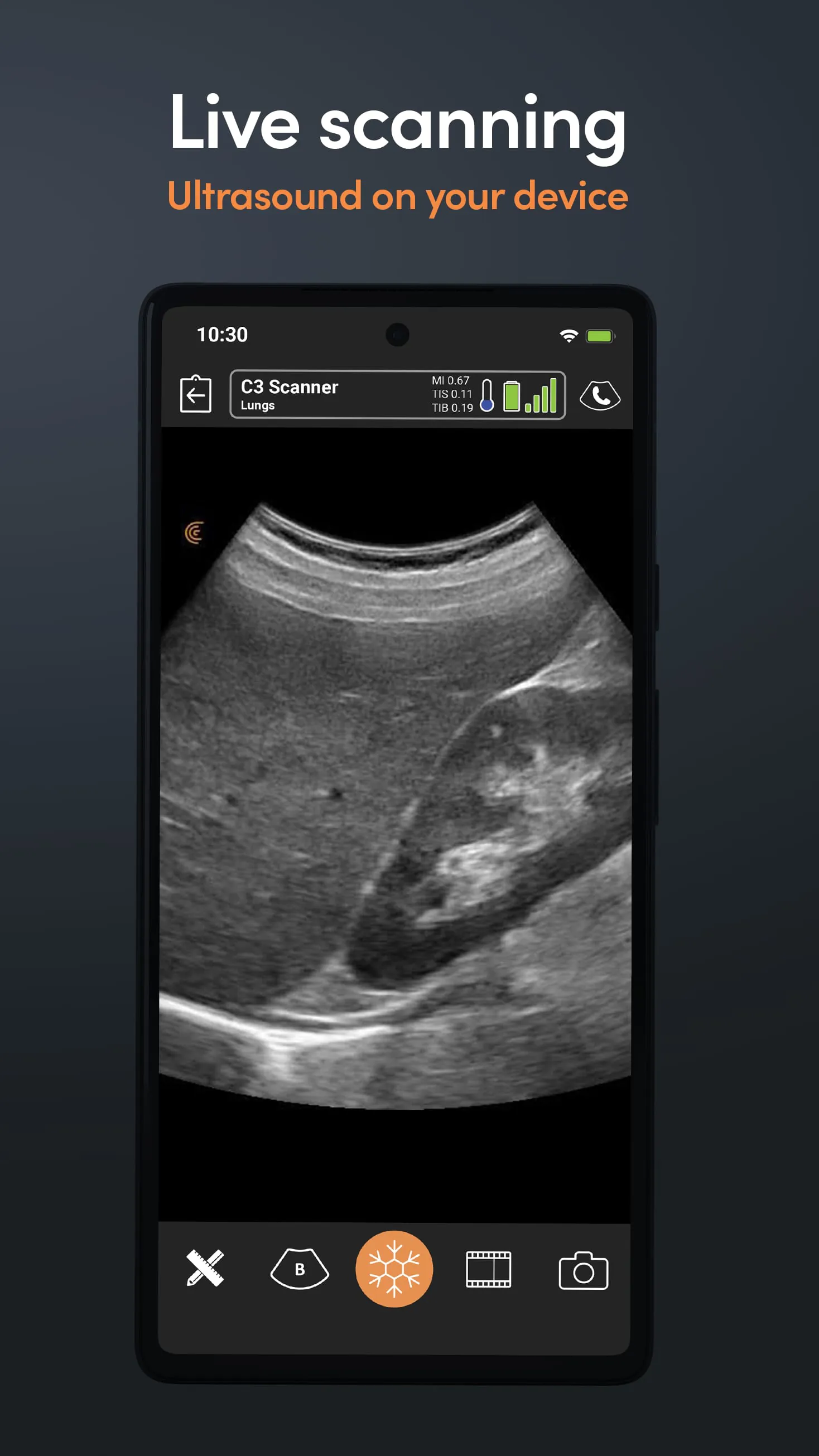 Clarius Ultrasound